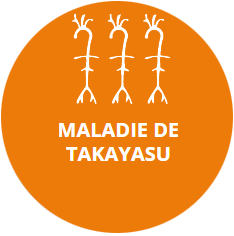 Maladie de Takayasu maladies vasculaires HEGP