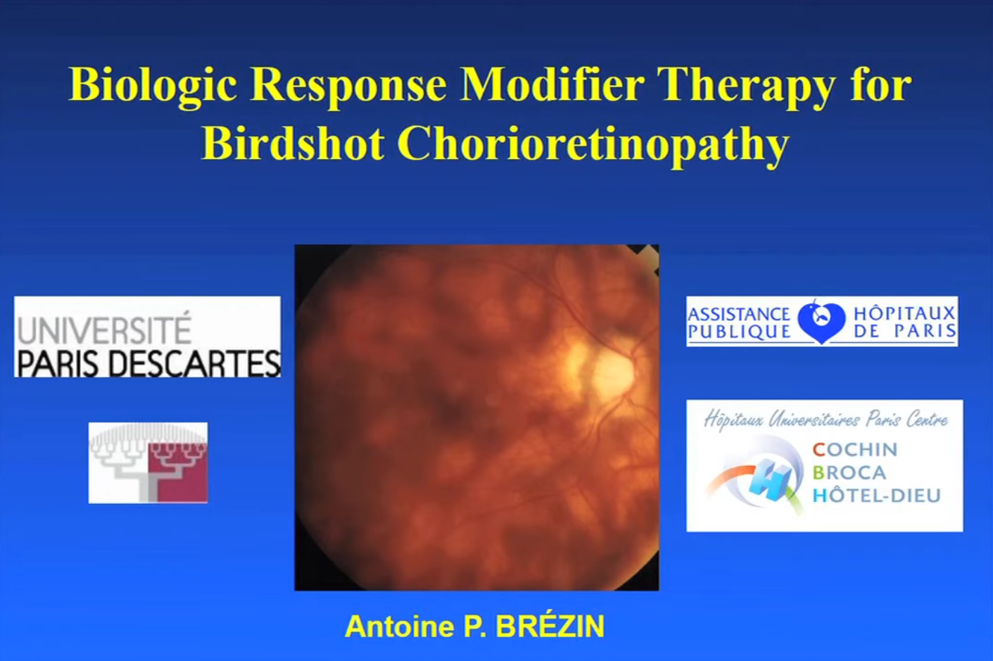 Vignette video Birshot Ophtara Brezin 1